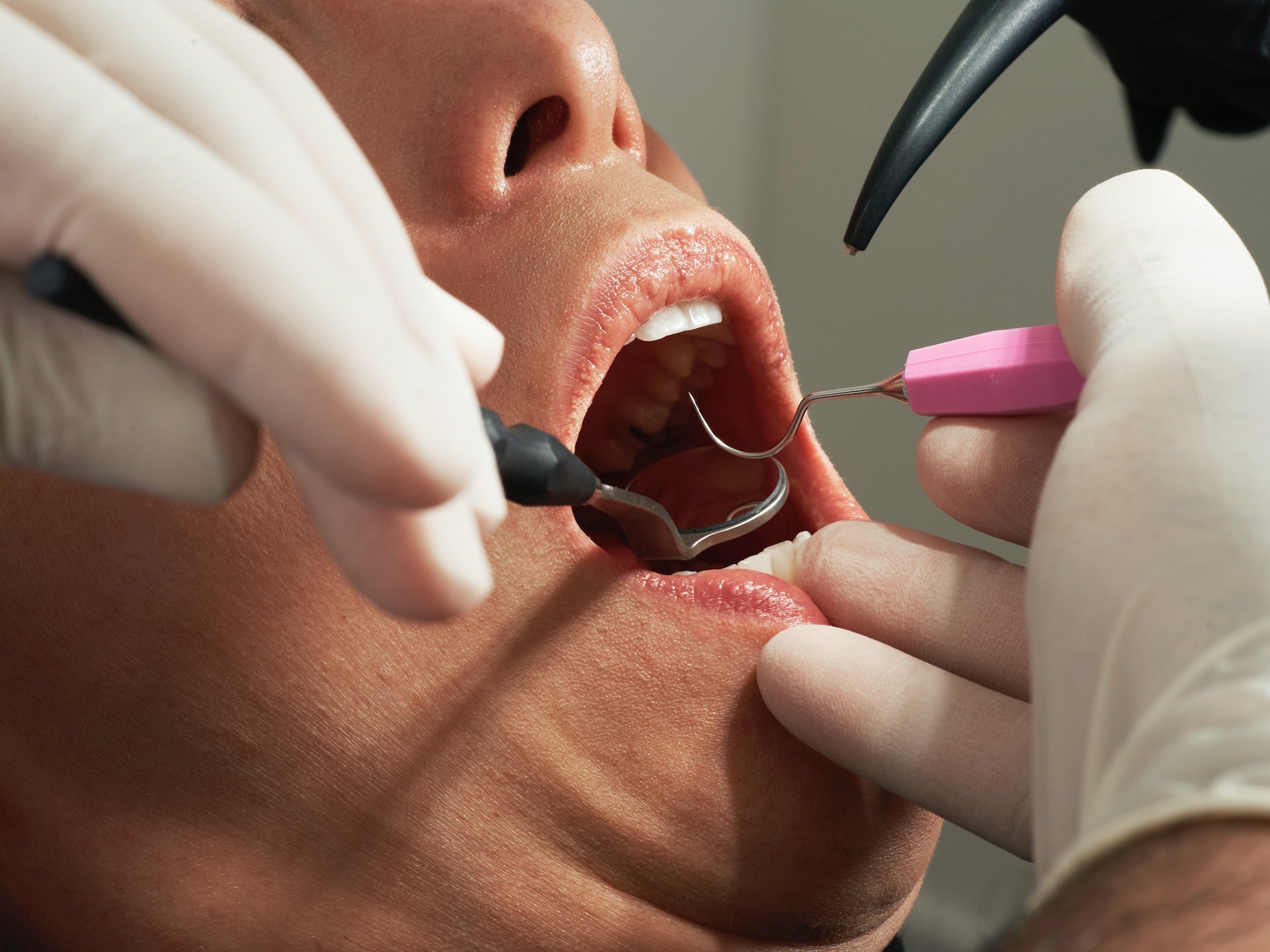 Embracing Dental Visits: Steps to Overcome Fear of the Dentist