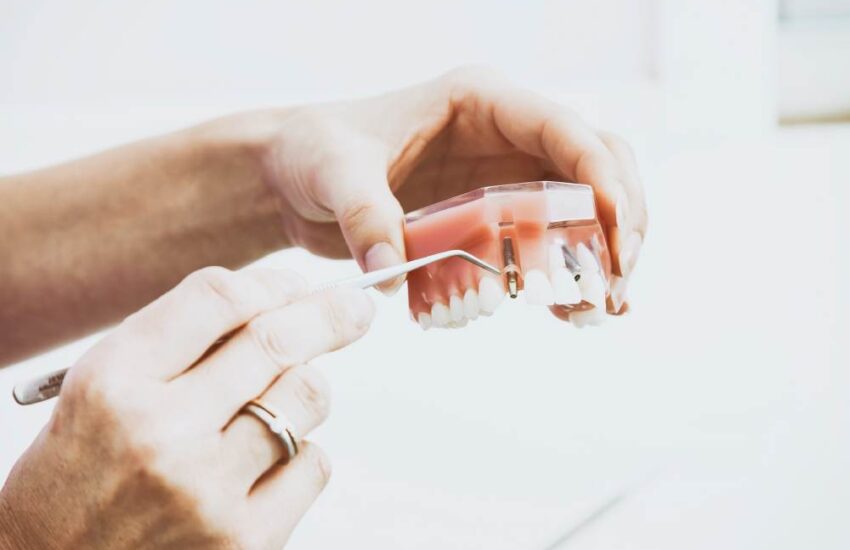 How Do You Know If Dental Implants Are Right For You