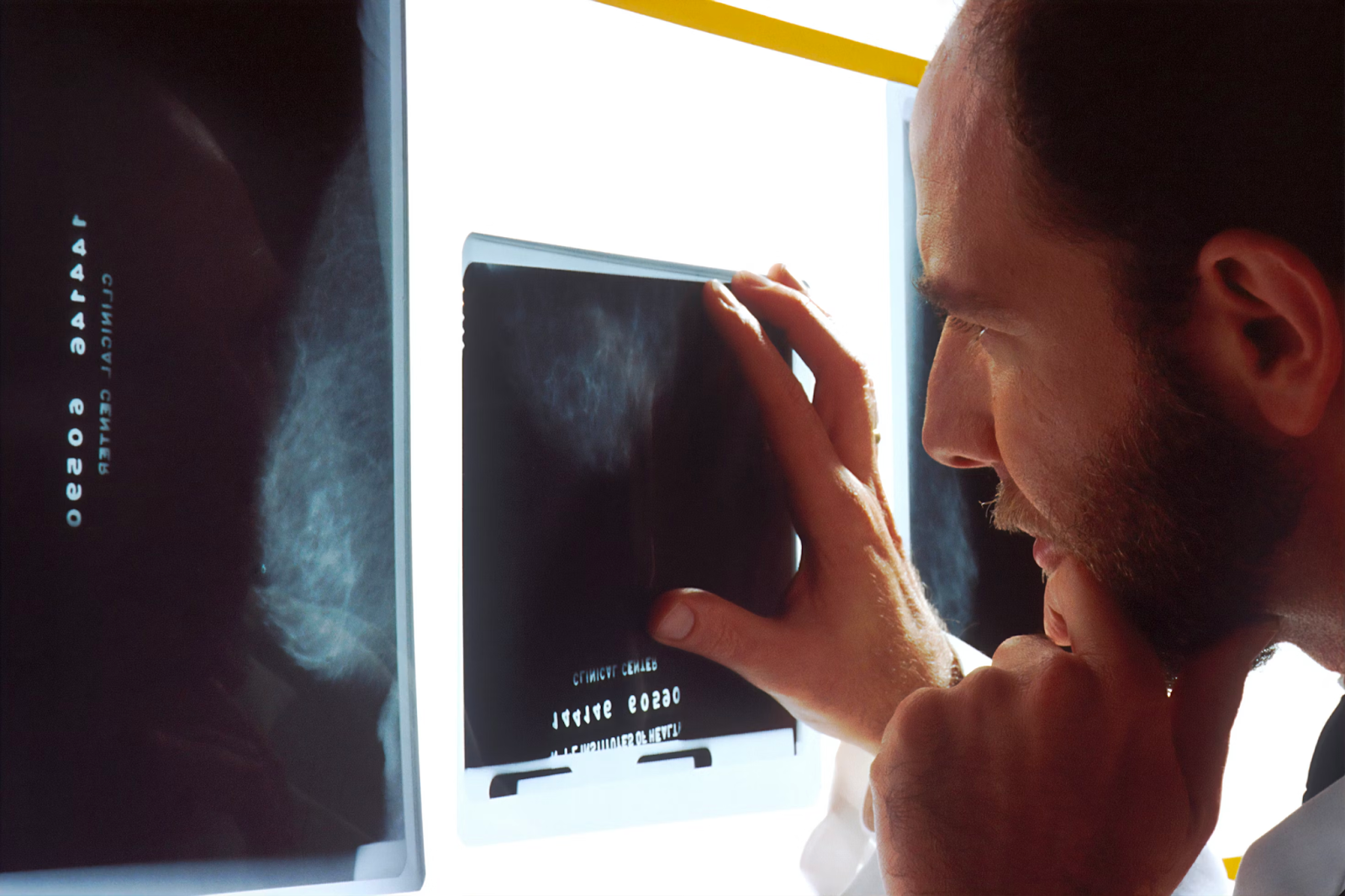 A Comprehensive Guide On How To Enhance Your Radiology Information System