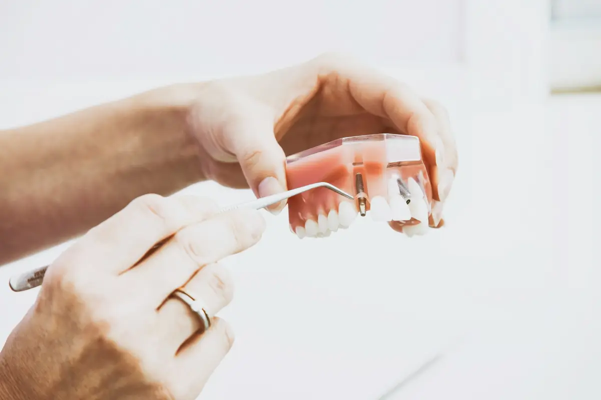 The Journey to a Perfect Smile: How Dental Implants Can Transform Your Life
