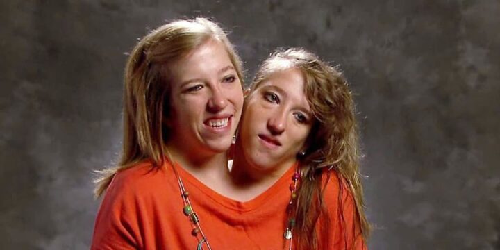 Abby and Brittany net worth
