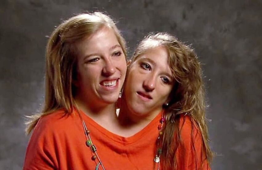 Abby and Brittany net worth