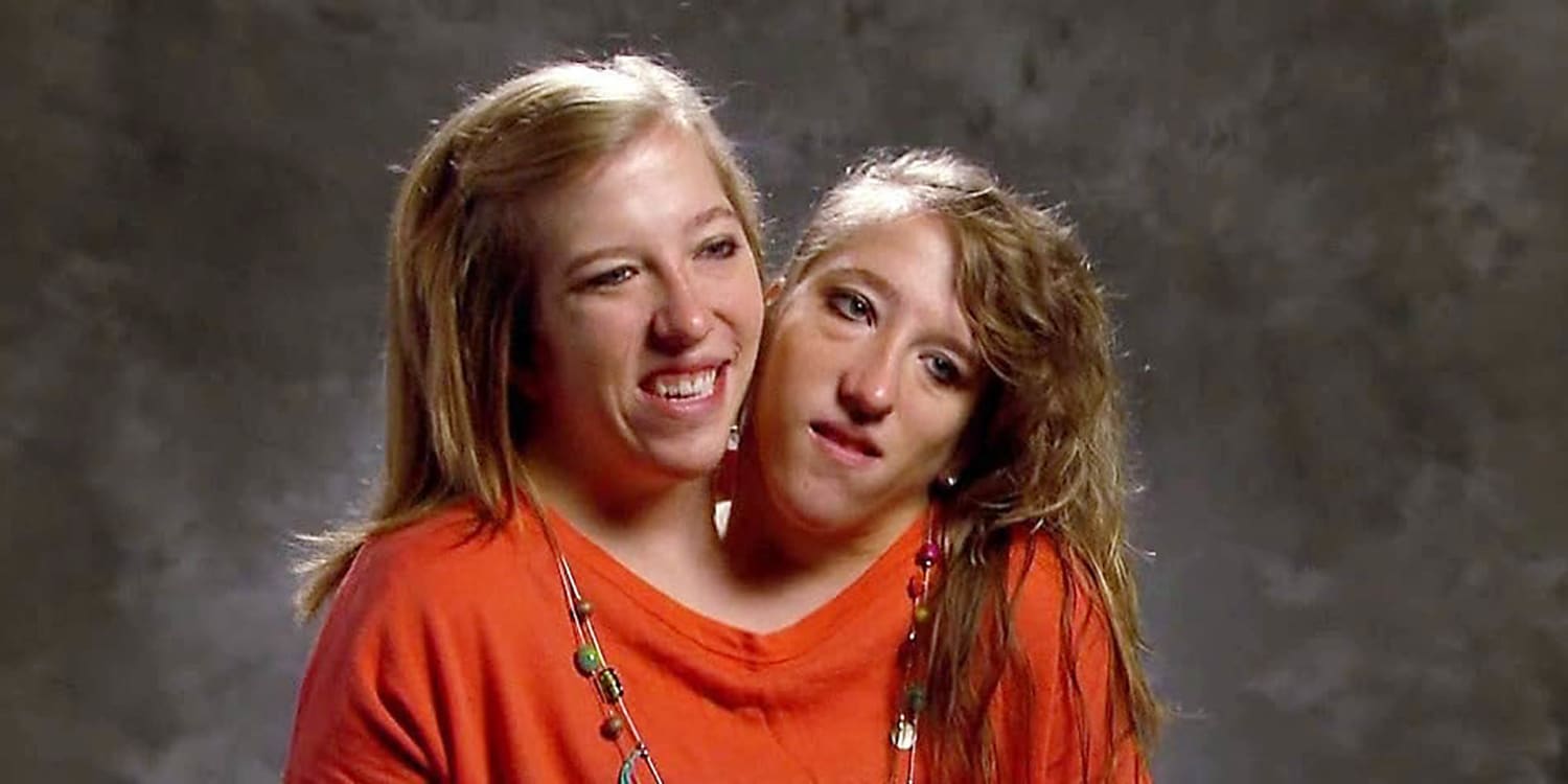Abby and Brittany Net Worth